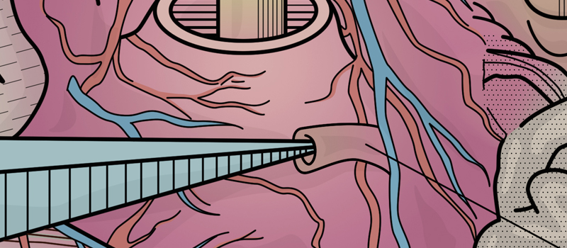 Organs by Cycle Hiccups